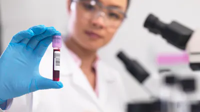 Scientist preparing clinical samples for medical testing in a laboratory