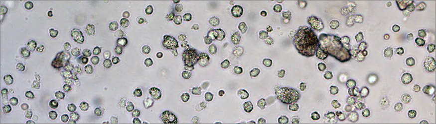 Dendritic cells collected from a 3D scaffold three days after in vivo injection