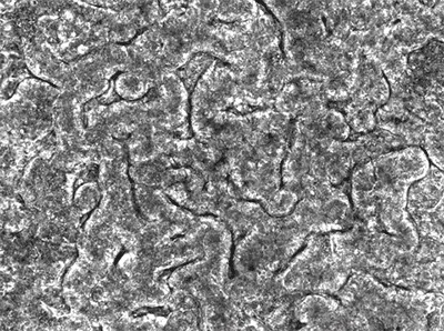 The Wyss Institute's human gut-on-a-chip
